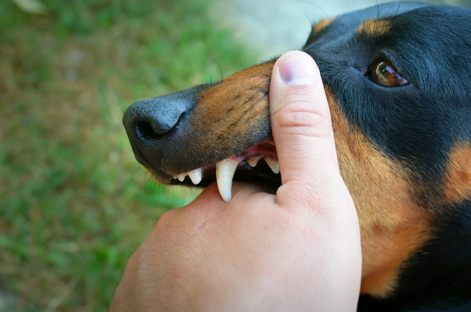 human bite by a dog