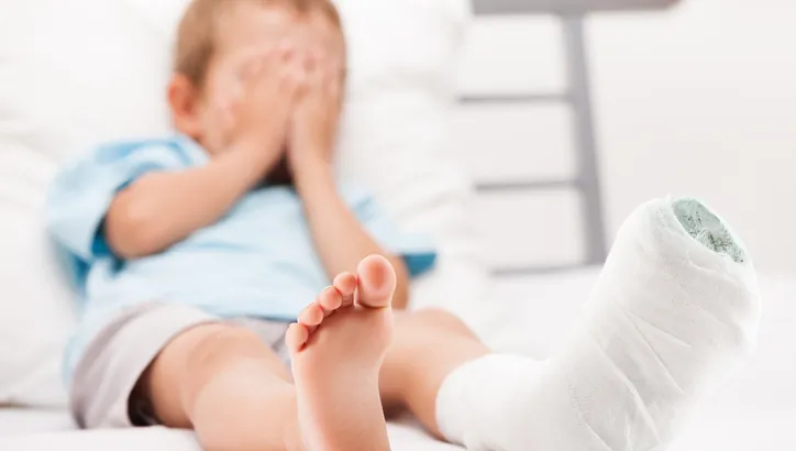 A child lies on a bed with one leg in a cast, covering their face with their hands.